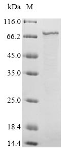 Human Fusion glycoprotein F0 protein