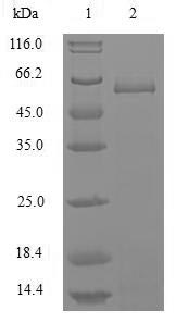Viral Nucleoprotein protein