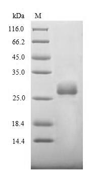 Viral Spike glycoprotein protein