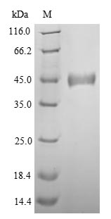 Viral Nucleoprotein protein