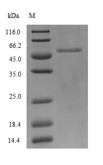 Viral Nucleoprotein protein