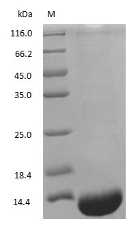 Rabbit Hemoglobin protein
