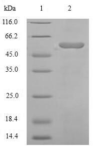 Human Angiotensinogen protein
