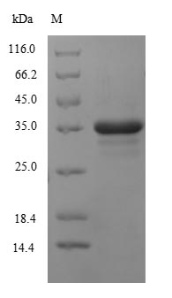 Human CYBB protein