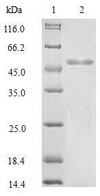 Human KRT18 protein