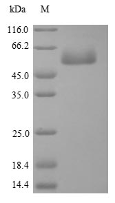 Chicken PTK2 protein