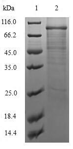 Viral VACWR062 protein
