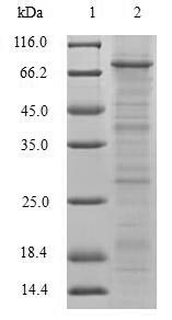 Human TRIM5 protein
