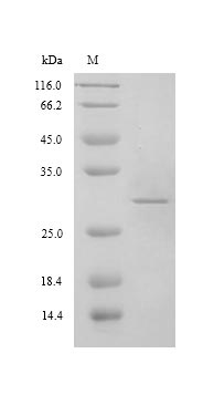 Viral ORF2 protein