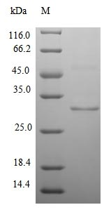 Mouse Pdk3 protein