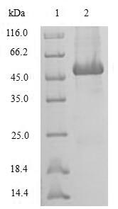 Human SRI protein