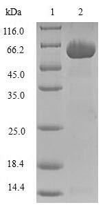 Human AKR1C3 protein