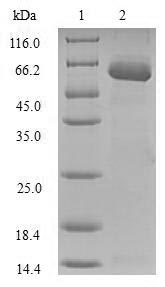 Human SULT1A1 protein