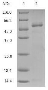 Human AK2 protein