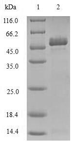 Human TIRAP protein