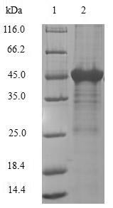 Human APRT protein
