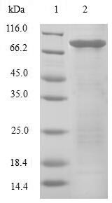Human EIF3E protein