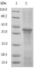 Human GLRX2 protein