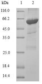 Human PHYH protein