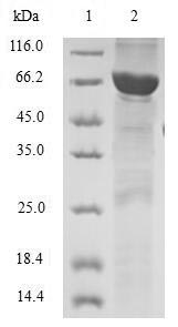 Human TWF2 protein