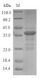 Human S100A12 protein