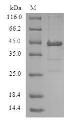 Human ACP1 protein