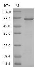 Human AKR1C4 protein