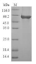 Human CA8 protein