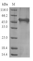 Human NCS1 protein
