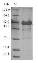 Human GBA3 protein