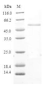 Human RNF125 protein