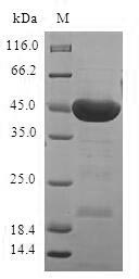 Human STK32A protein