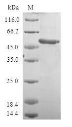 Human VENTX protein