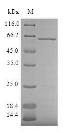 Human AKR7A3 protein