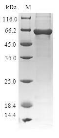 Human TARBP2 protein