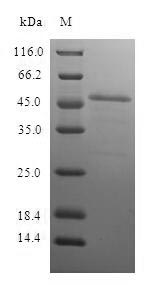 Human PSMB10 protein