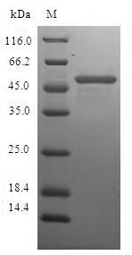 Human CHMP2B protein