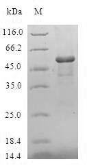 Human GSTZ1 protein
