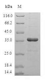 Human HBXIP protein