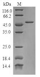 Human TPD52L1 protein