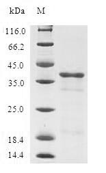 Human TUSC2 protein