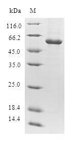 Human DTYMK protein