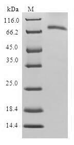 Human SEPHS1 protein