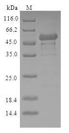 Human NMNAT1 protein