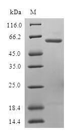 Human UFD1L protein