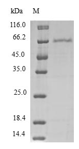 Human PDCD2L protein