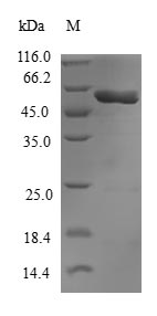 Human GNB1L protein