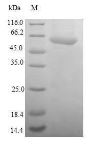 Human SAE1 protein