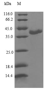 Human CALML3 protein