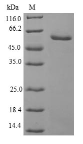 Human UBE2S protein